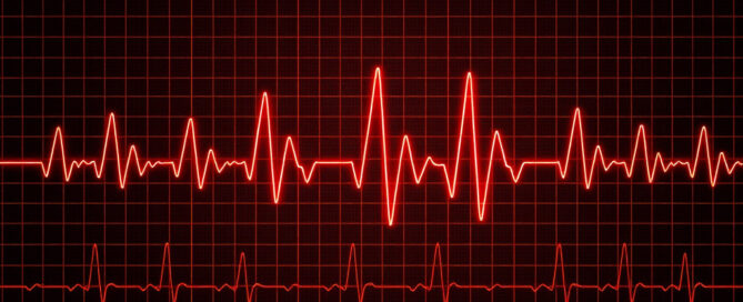 L’intelligenza artificiale applicata all’ECG: il costo della trasparenza