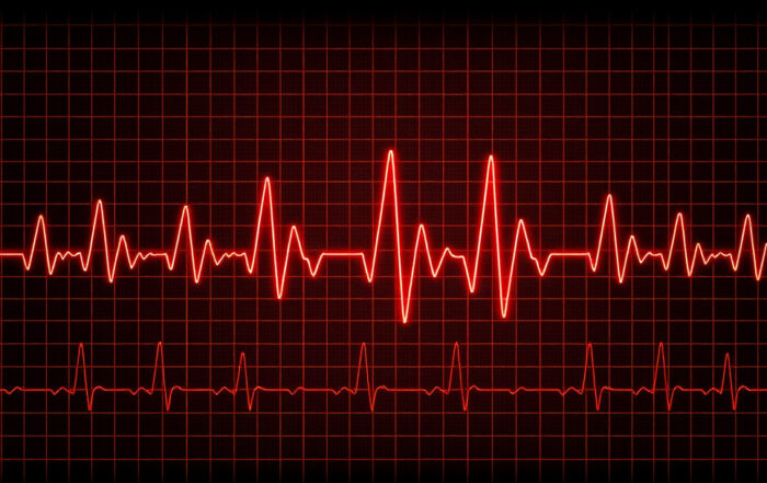 L’intelligenza artificiale applicata all’ECG: il costo della trasparenza